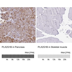 PLA2G1B Antibody, Novus Biologicals:Antibodies:Primary Antibodies